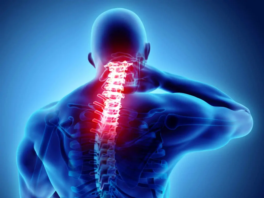Cervical Pain